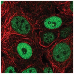 BCL9-2 Antibody, Novus Biologicals 25 &mu;L:Antibodies, Polyclonal