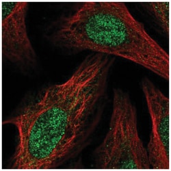BCOR Antibody, Novus Biologicals 25 &mu;L, Unlabeled:Antibodies, Polyclonal