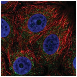 BDH1 Antibody, Novus Biologicals 25 &mu;L:Antibodies, Polyclonal