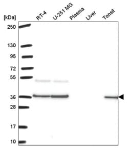 BDNF Antibody, Novus Biologicals 100&mu;L; Unlabeled:Antibodies, Polyclonal