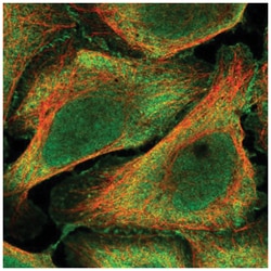 Bend6 Antibody, Novus Biologicals 25 &mu;L:Antibodies, Polyclonal