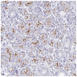 Bestrophin 1 Antibody, Novus Biologicals 25 &mu;L:Antibodies, Polyclonal