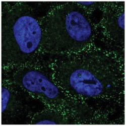 Beta 2 Adaptin Antibody, Novus Biologicals 25 &mu;L, Unlabeled:Antibodies,