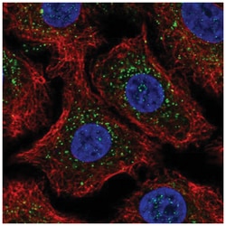beta-Arrestin 2 Antibody, Novus Biologicals 100&mu;L; Unlabeled:Antibodies,