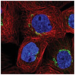 beta-Galactosidase-1/GLB1 Antibody, Novus Biologicals:Antibodies:Primary