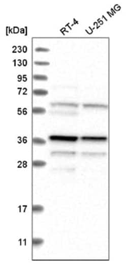Biliverdin Reductase A/BLVRA Antibody, Novus Biologicals 100&mu;L; Unlabeled:Antibodies,