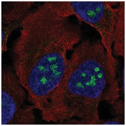 BLCAP Antibody, Novus Biologicals 100&mu;L; Unlabeled:Antibodies, Polyclonal