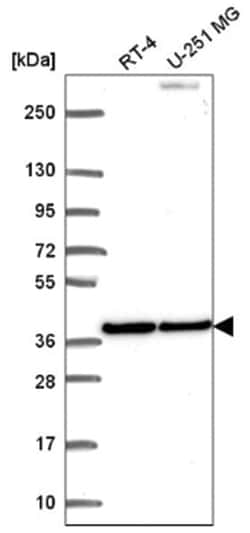 BMP-2 Antibody, Novus Biologicals 25 &mu;L, Unlabeled:Antibodies, Polyclonal