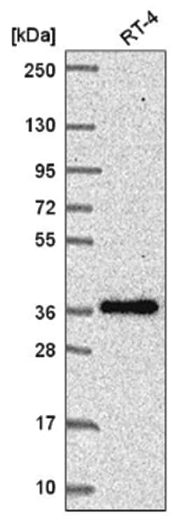BMP-7 Antibody, Novus Biologicals 100&mu;L; Unlabeled:Antibodies, Polyclonal