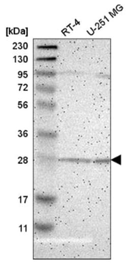 BNIP1 Antibody, Novus Biologicals 25 &mu;L; Unlabeled:Antibodies, Polyclonal