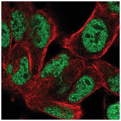 BOC Antibody, Novus Biologicals 100&mu;L; Unlabeled:Antibodies, Polyclonal