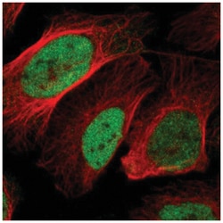 BOC Antibody, Novus Biologicals 100&mu;L; Unlabeled:Antibodies, Polyclonal