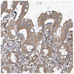 BOLA2 Antibody, Novus Biologicals 25 &mu;L | Buy Online | Novus Biologicals | Fisher Scientific