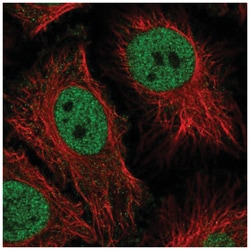 BRAF35 Antibody, Novus Biologicals:Antibodies:Primary Antibodies