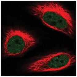 BRAF35 Antibody, Novus Biologicals:Antibodies:Primary Antibodies