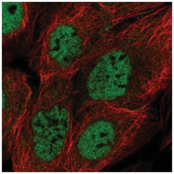 BRCC3 Antibody, Novus Biologicals:Antibodies:Primary Antibodies