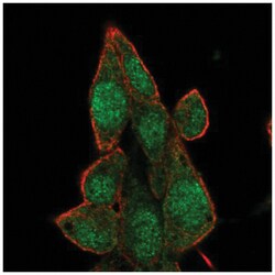 BRD7 Antibody, Novus Biologicals 100&mu;L; Unlabeled:Antibodies, Polyclonal