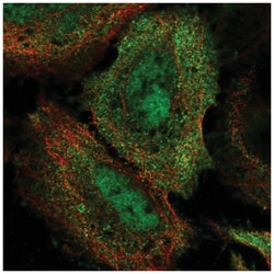 BRD7 Antibody, Novus Biologicals 100&mu;L; Unlabeled:Antibodies, Polyclonal