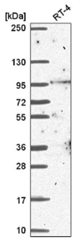 Breast carcinoma amplified sequence 3 Antibody, Novus Biologicals 25 &mu;L,