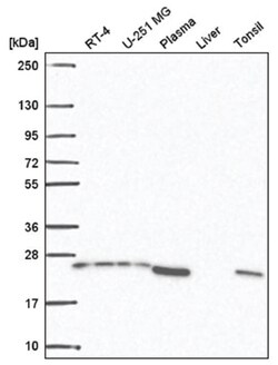 BRICD5 Antibody, Novus Biologicals 100&mu;L; Unlabeled:Antibodies, Polyclonal