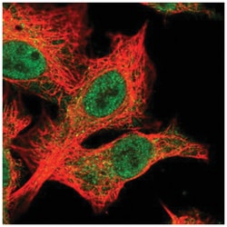 BTBD12 Antibody, Novus Biologicals 25 &mu;L, Unlabeled:Antibodies, Polyclonal
