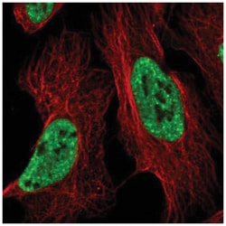 BTF Antibody, Novus Biologicals 25 &mu;L; Unlabeled:Antibodies, Polyclonal