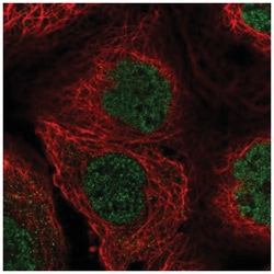 Buster3 Antibody, Novus Biologicals:Antibodies:Primary Antibodies