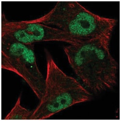 c-Myc Antibody, Novus Biologicals 25 &mu;L, Unlabeled:Antibodies, Polyclonal