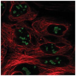 CC2D2B Antibody, Novus Biologicals:Antibodies:Primary Antibodies