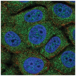TMEM254 Antibody, Novus Biologicals 100 &mu;L | Buy Online | Novus Biologicals | Fisher Scientific