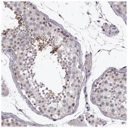 C10orf62 Antibody, Novus Biologicals 25 &mu;L, Unlabeled:Antibodies, Polyclonal