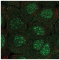 C10orf67 Antibody, Novus Biologicals:Antibodies:Primary Antibodies