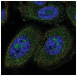 CCDC7 Antibody, Novus Biologicals:Antibodies:Primary Antibodies