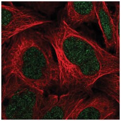 C11orf1 Antibody, Novus Biologicals 100&mu;L; Unlabeled:Antibodies, Polyclonal