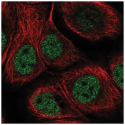 C11orf71 Antibody, Novus Biologicals 25 &mu;L, Unlabeled:Antibodies, Polyclonal