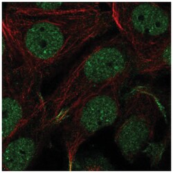 C11orf71 Antibody, Novus Biologicals:Antibodies:Primary Antibodies