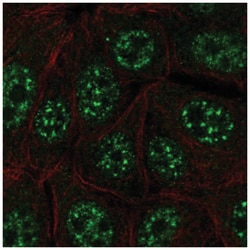GRCC10 Antibody, Novus Biologicals 25 &mu;L:Antibodies, Polyclonal