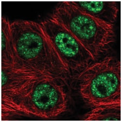 GRCC10 Antibody, Novus Biologicals 100&mu;L; Unlabeled:Antibodies, Polyclonal