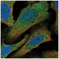 C14orf28 Antibody, Novus Biologicals 25 &mu;L:Antibodies, Polyclonal