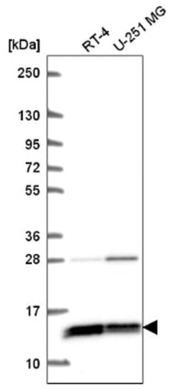 WDR83OS Antibody, Novus Biologicals 100 &mu;L | Buy Online | Novus Biologicals | Fisher Scientific