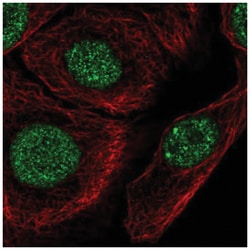 C1orf174 Antibody, Novus Biologicals:Antibodies:Primary Antibodies