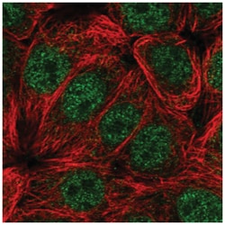 CIART Antibody, Novus Biologicals 100 &mu;L | Buy Online | Novus Biologicals | Fisher Scientific