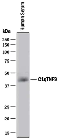Human CTRP9/C1qTNF9 Antibody, R D Systems 100&mu;g; Unlabeled:Antibodies,