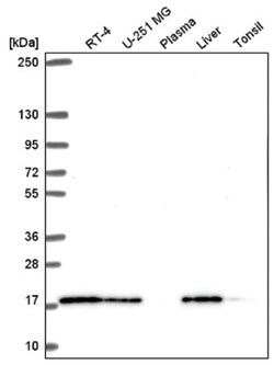 TMEM230 Antibody, Novus Biologicals 25 &mu;L:Antibodies, Polyclonal