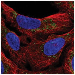 M1AP Antibody, Novus Biologicals 25 &mu;L, Unlabeled:Antibodies, Polyclonal