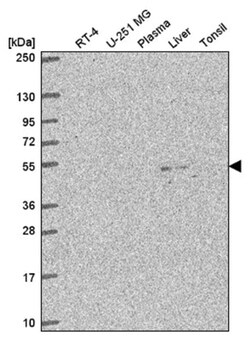 C3orf67 Antibody, Novus Biologicals 25 &mu;L, Unlabeled:Antibodies, Polyclonal