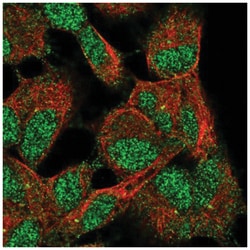 TMEM103 Antibody, Novus Biologicals 25 &mu;L; Unconjugated:Antibodies,