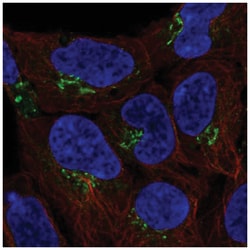 FAM241A Antibody, Novus Biologicals 100&mu;L; Unlabeled:Antibodies, Polyclonal