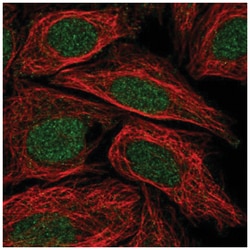 C5orf24 Antibody, Novus Biologicals:Antibodies:Primary Antibodies