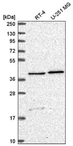 SLC18B1 Antibody, Novus Biologicals 25 &mu;L, Unlabeled:Antibodies, Polyclonal